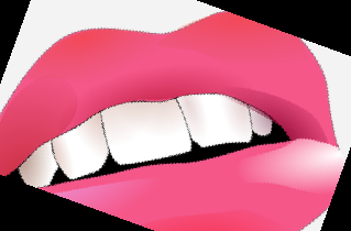 임플란트 가격 종류 비용