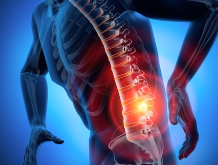 허리디스크 증상