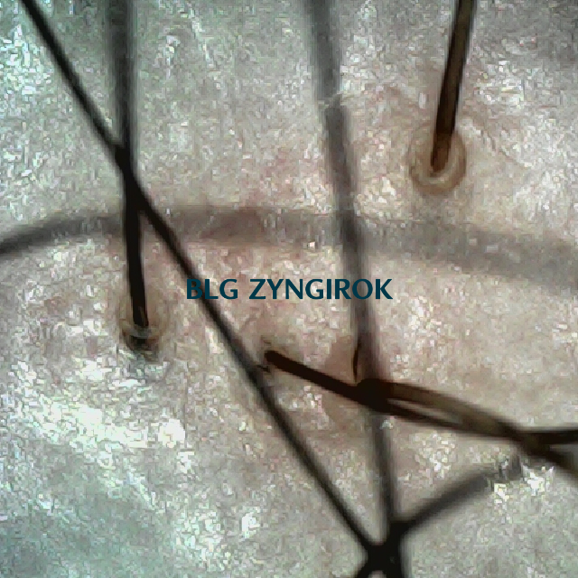 탈모 극복 프로젝트 - 정수리와 이마 사이 두피 모습이다.