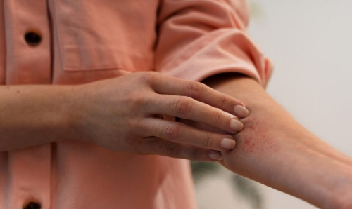 크릴오일 효능 부작용