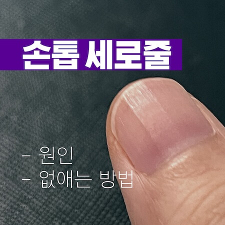 손톱-세로줄-썸네일
