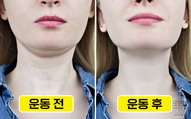 윤곽주사 턱선 살리기 운동 턱선리프팅 마사지