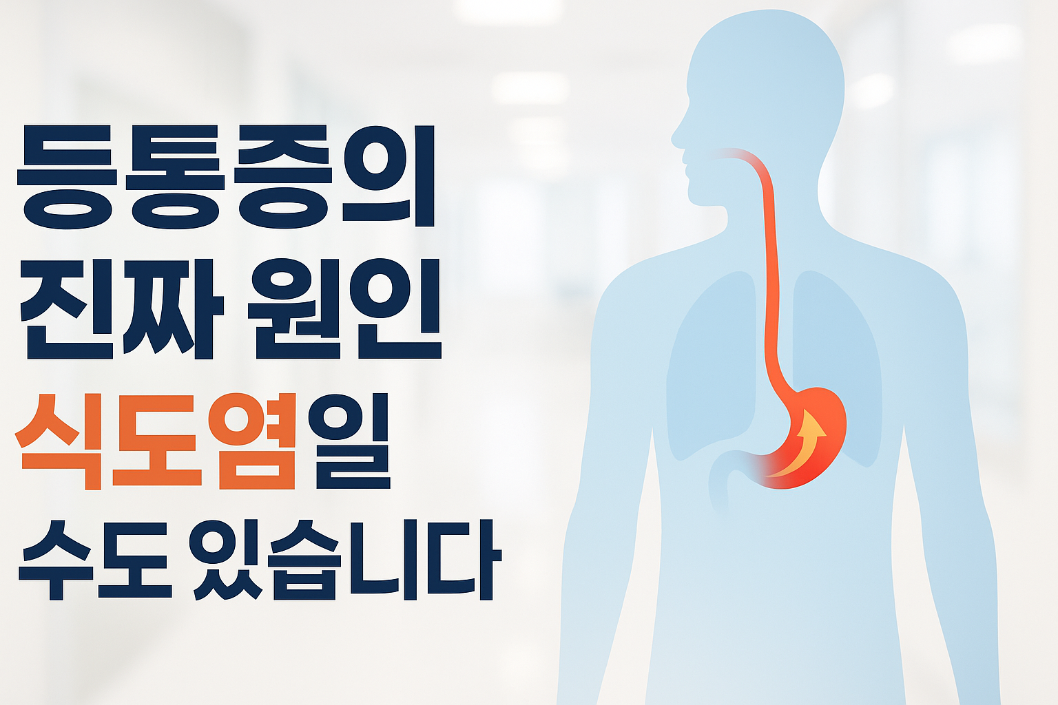 역류성 식도염 증상 앉았을때 등통증 관리에 대해 알아보기
