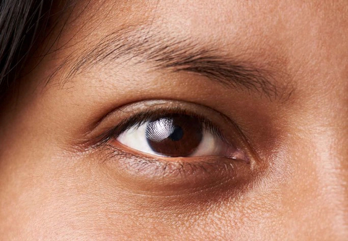 다크서클에좋은음식 추천