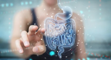 염증성 장 질환