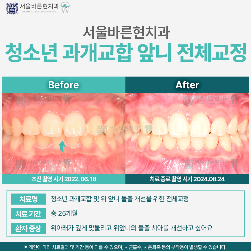 해운대교정치과