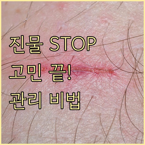 아토피 진물, 더 이상 고민은 끝! ..