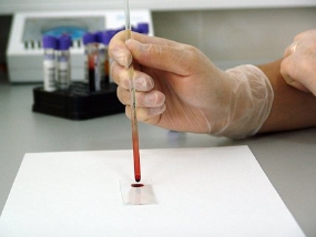 고혈압-낮추는-방법