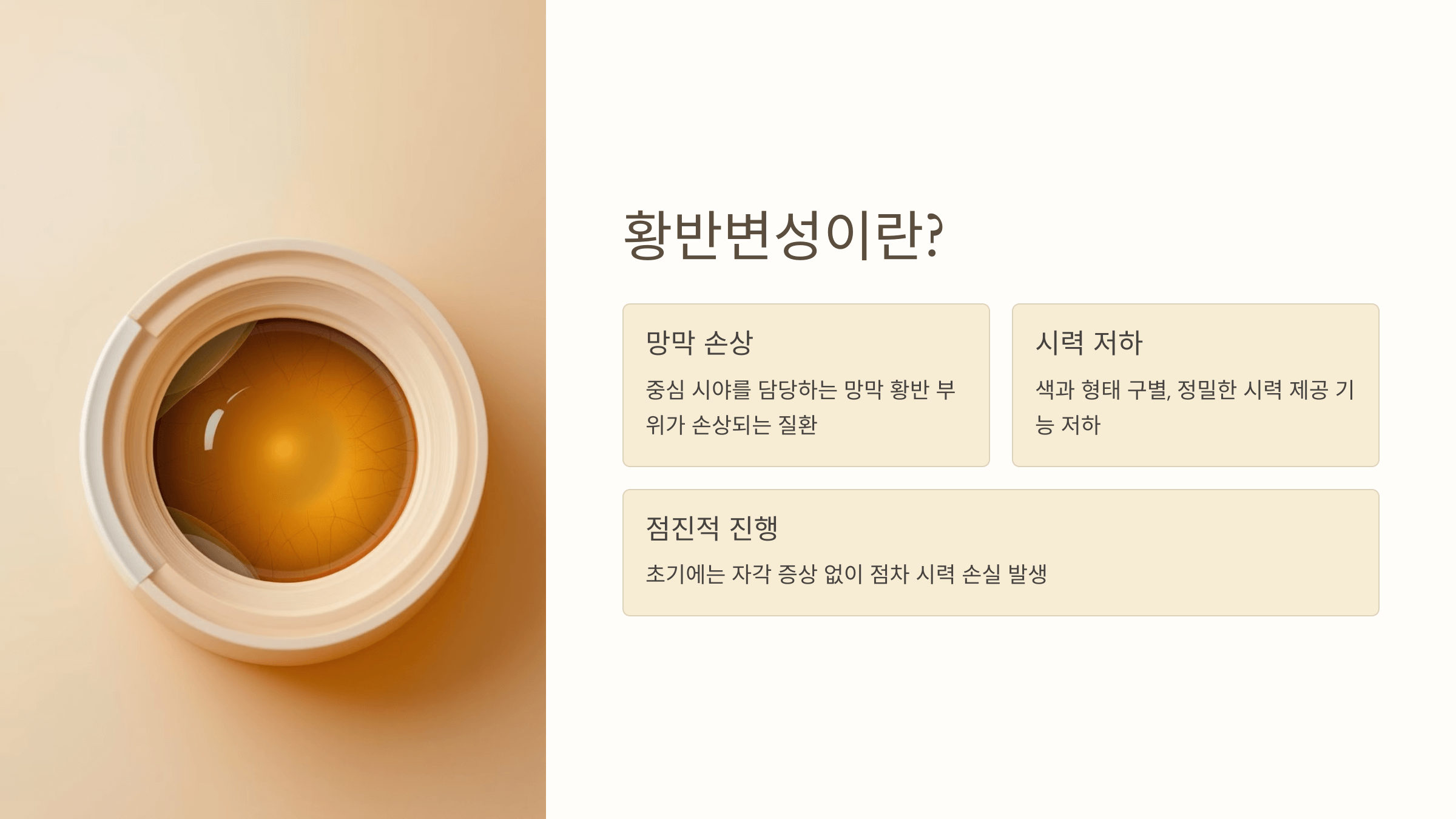 황반변성과 관련된 사진입니다.