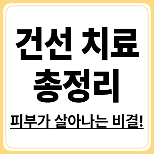 건선 치료법 완전 가이드, 약부터 빛 치료까지
