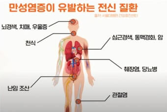 만성염증이 생기는 곳