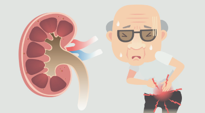 콩팥이 안좋으면 나타나는 증상입니다.