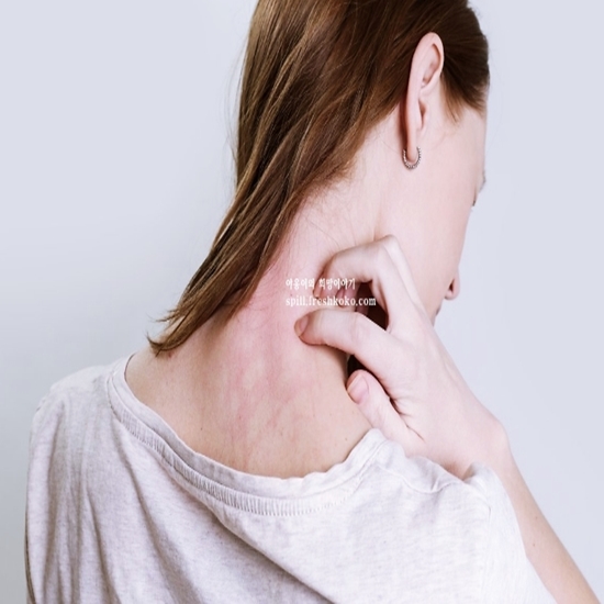 면역력이 떨어졌을때 증상