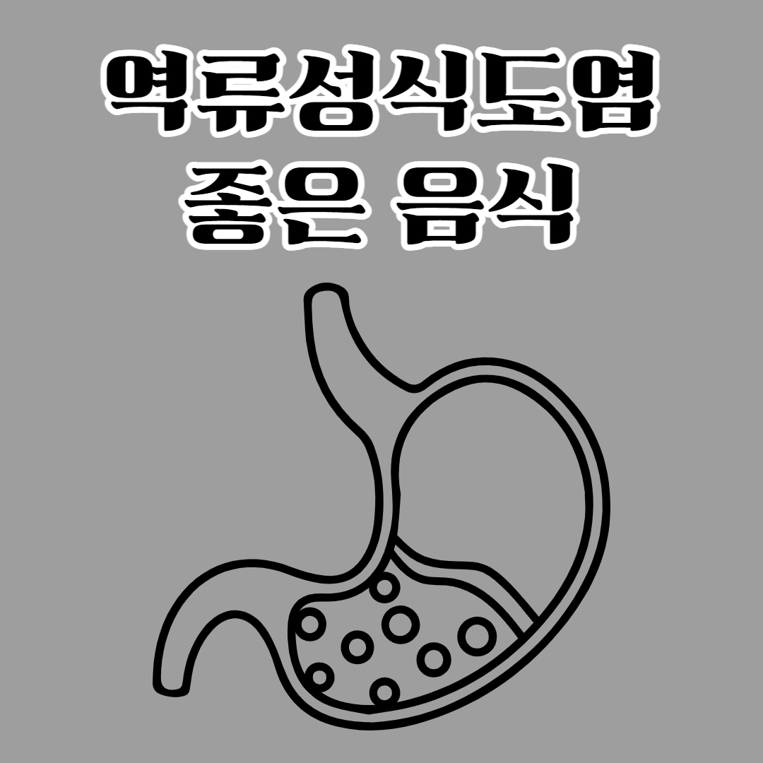 역류성 식도염 도움 완화 음식