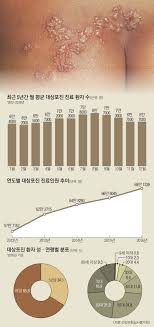 대상포진 초기증상