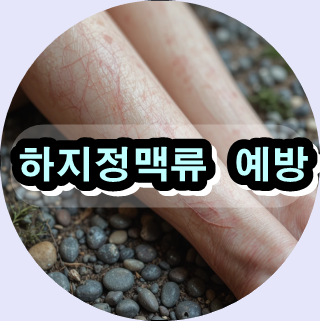 하지정맥류 증상,하지정맥류 치료법,하지정맥류 수술 비용,하지정맥류 자연치유,하지정맥류 예방 운동,하지정맥류 압박스타킹,하지정맥류 원인,하지정맥류 레이저 치료,하지정맥류 다리 붓기,하지정맥류 한방 치료