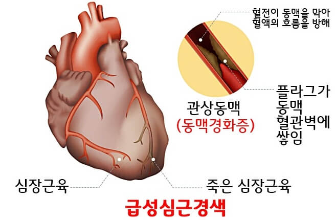 일러스트그림-설명하는글