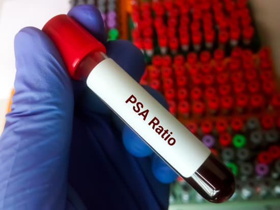 전립선 비대증 (Benign Prostatic Hyperplasia, BPH): 원인, 증상, 치료 및 관리 방법