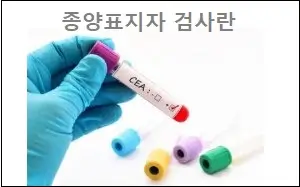 종양표지자 검사란