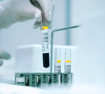 만성 신우신염 진단 기준 합병증 관리 방법