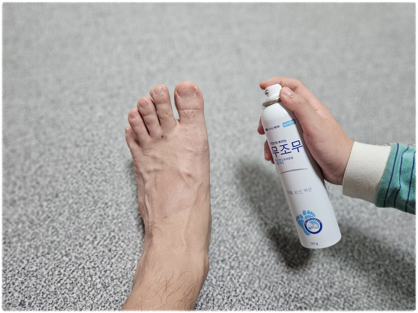 발에 무좀 스프레이를 사용하는 모습의 이미지