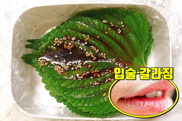 입안이 자주 헐때 좋은 음식 깻잎 효능,입병이 자주나는 이유