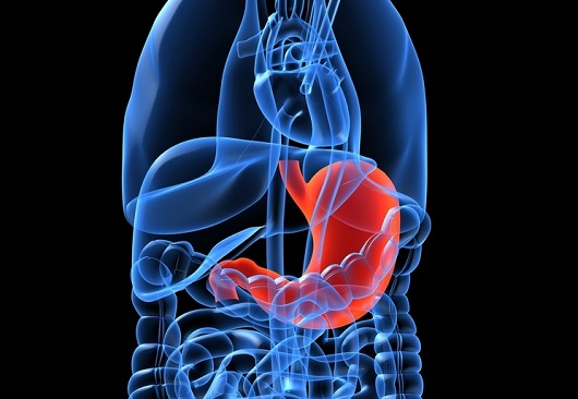 명의 위암 증상 예방 식품 식습관 생존율