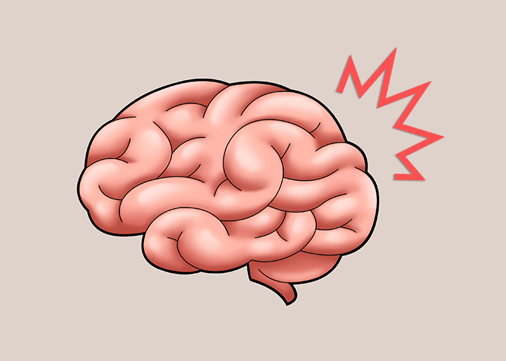 충격이-가해진-뇌