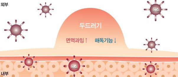 피부 발진 종류