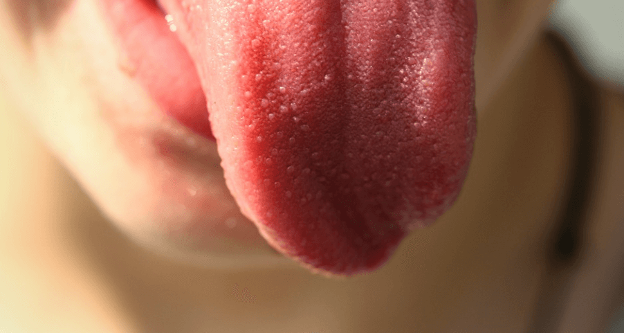 혓바닥이 갈라지는 이유 - 2