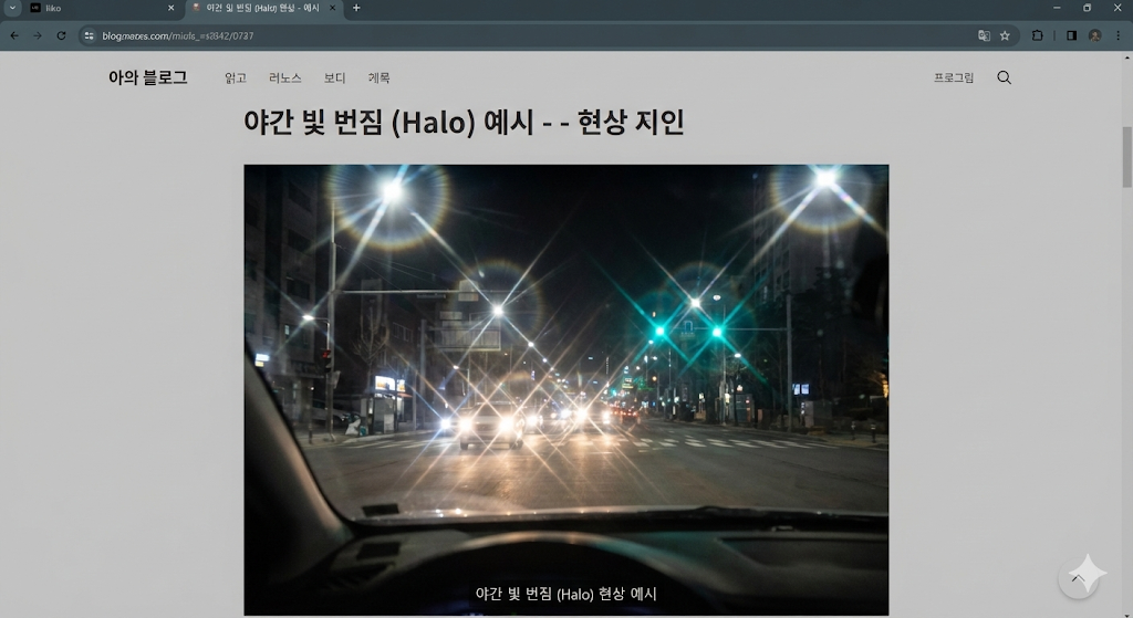 다초점 인공수정체 삽입 부작용