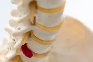 허리통증-원인