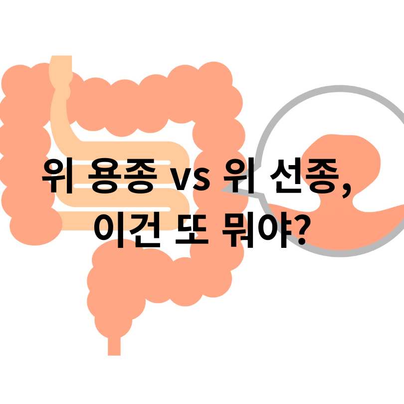 선종과 용종의 차이