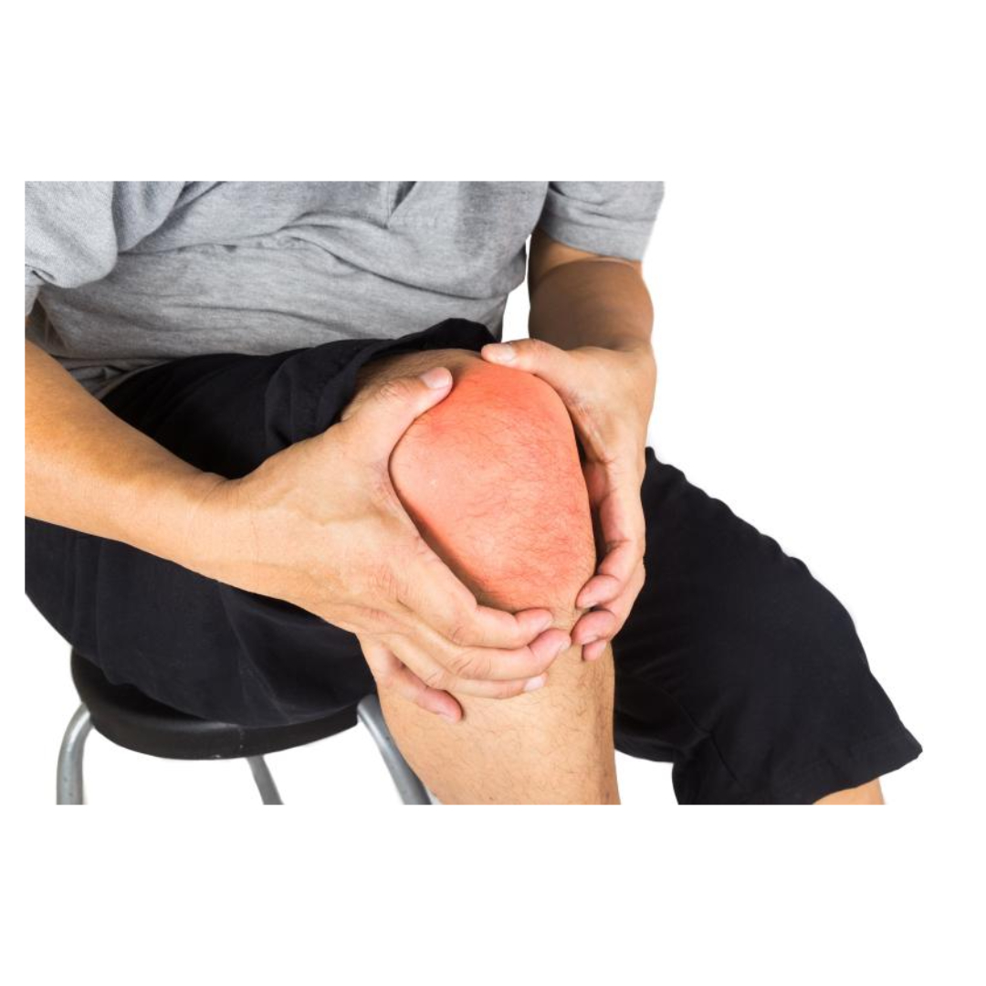 통풍과 관련된 사진입니다.