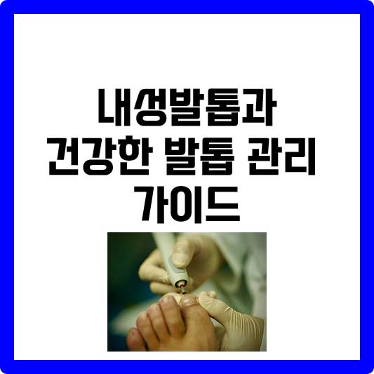 내성발톱치료병원과 내성발톱자가치료