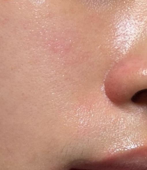 셀로라 포텐션 펜타샷 내돈내산