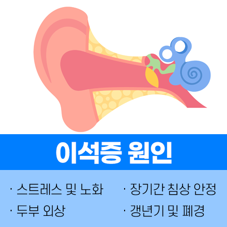 이석증