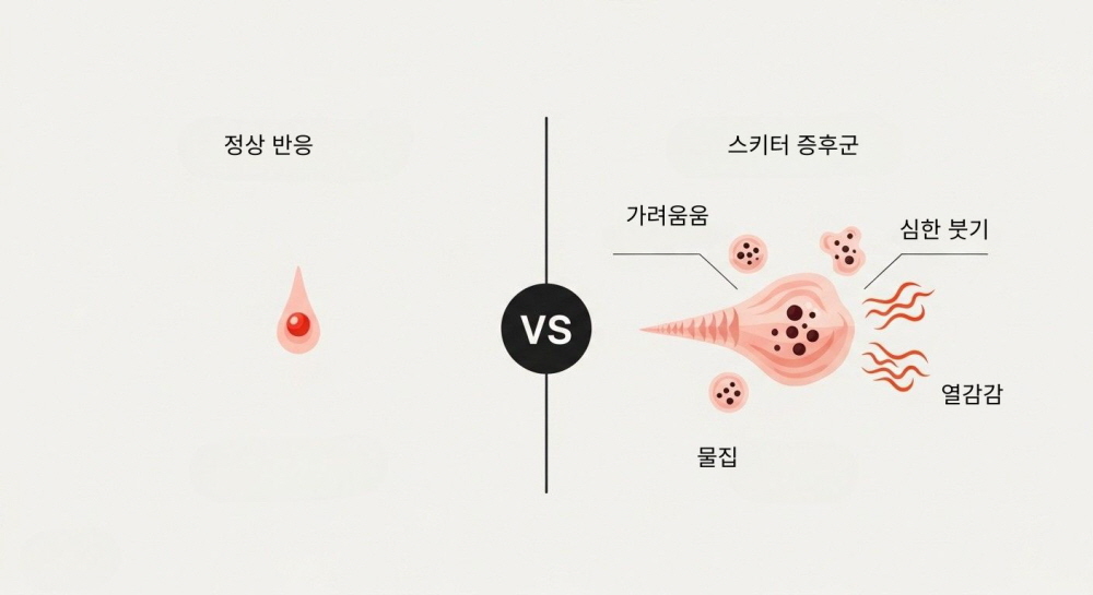 모기알러지