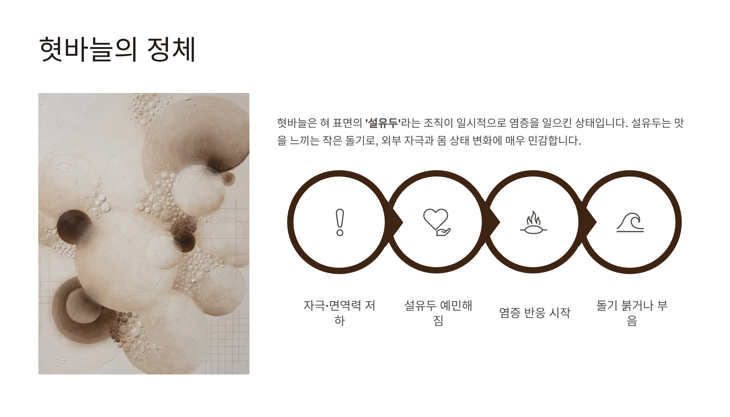 혓바늘이 돋는 이유