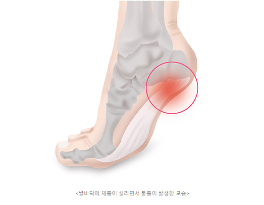 노화가 빨라지는 증거, 이런 증상 나타난다면?