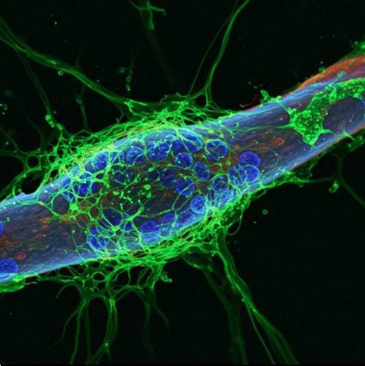 타우단백질 축적 이미지