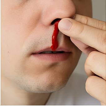 혈압높을때증상 궁금하셨죠?