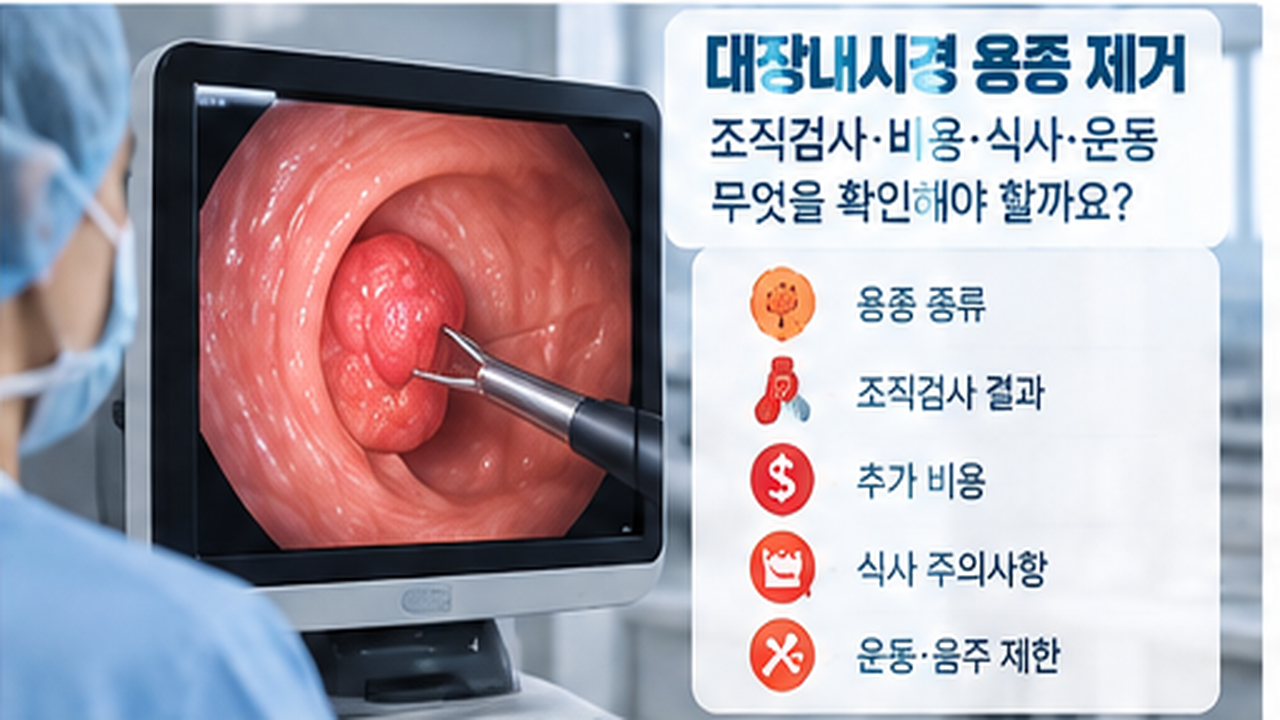 대장내시경 화면의 용종과 제거 과정을 설명하는 의료 이미지