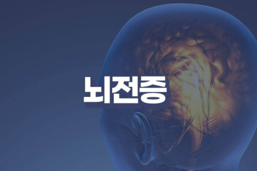 뇌전증