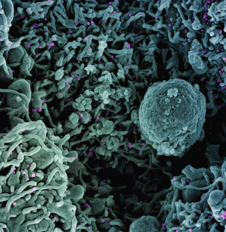 과민성 대장증후군 증상 예방 원인