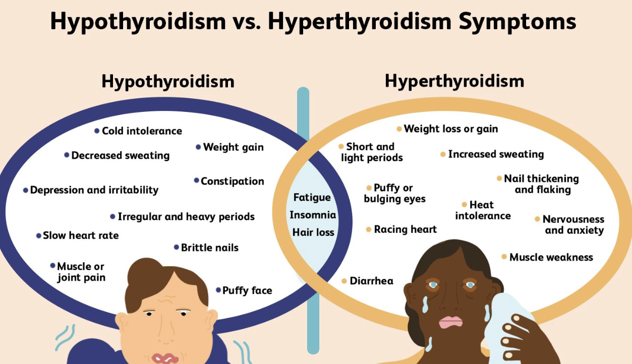 갑상선 기능 저하증 증상 1