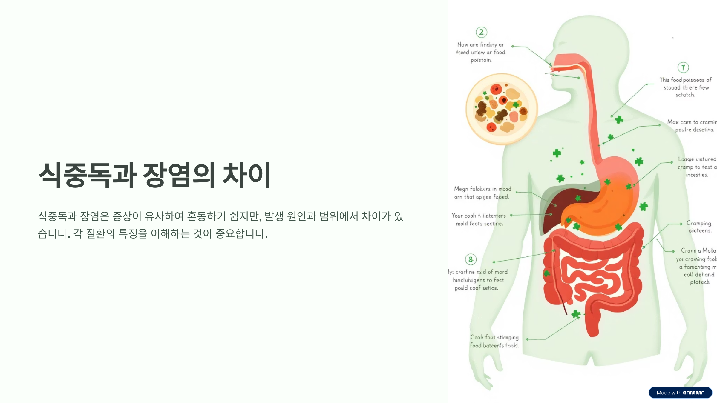 식중독과 장염의 차이 설명 이미지