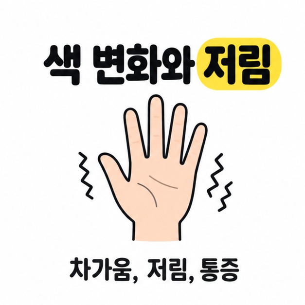 손 그림과 색 변화, 저림, 통증 문구로 대표 증상을 설명하는 그림