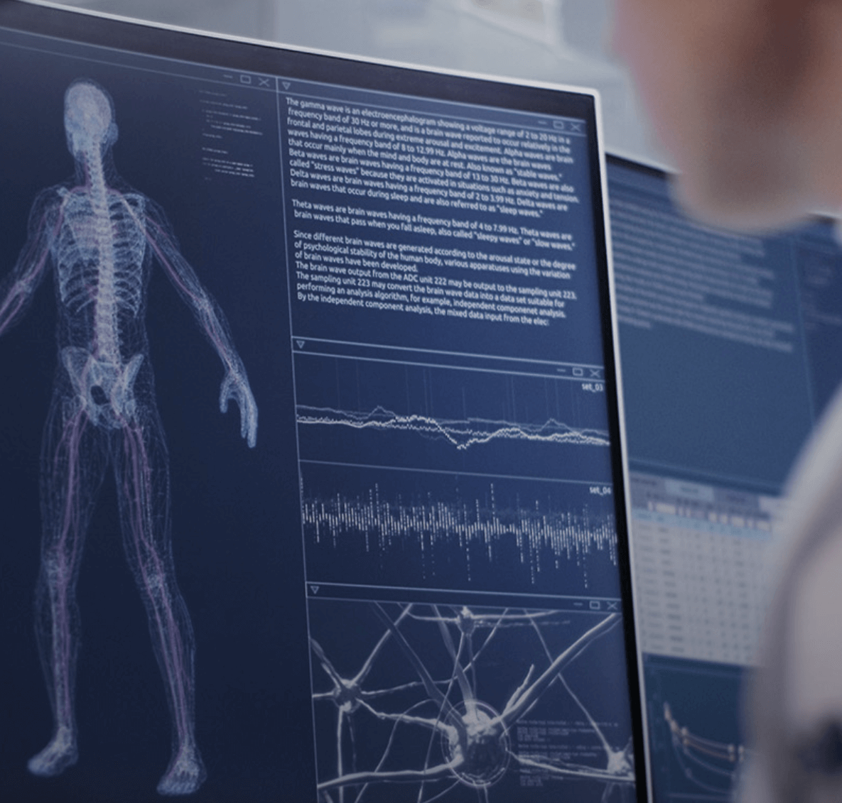 프로티나 공모주