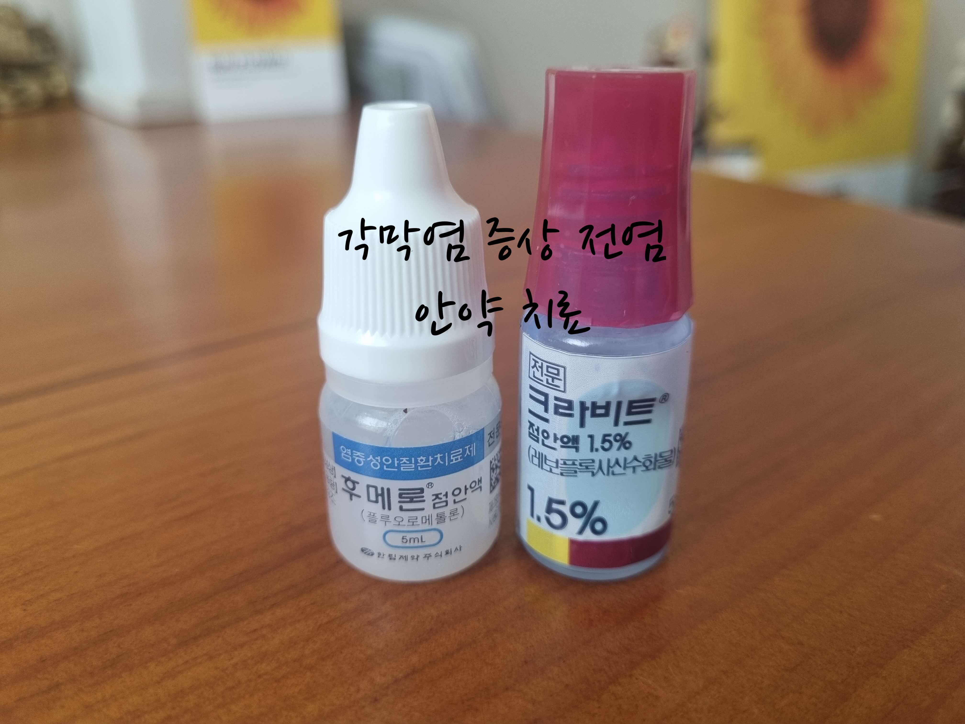 각막염 증상
